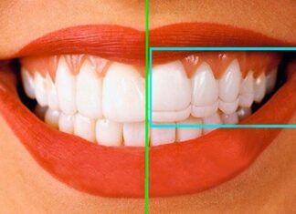 Лечение в области эстетической стоматологии