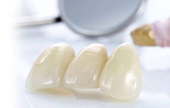 Лечение в области эстетической стоматологии