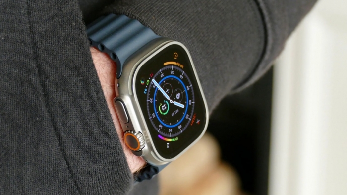 Apple Watch X: очередная инновация от Apple, которую хотят все