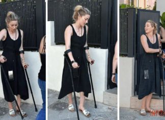 Эмбер Херд передвигается на костылях. Джонни Депп в этом не виноват