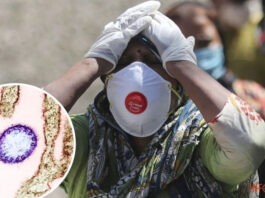 В Индии вспышка смертельной эпидемии: вирус убивает до 75% инфицированных, вакцины от него не существует