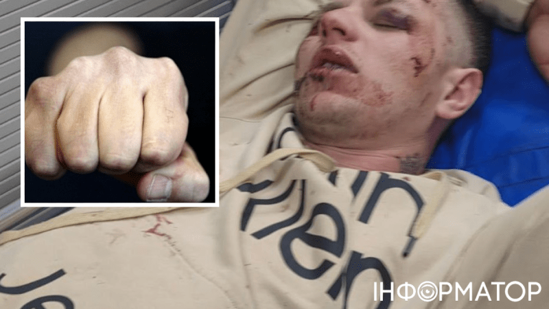 У російському Ростові побили "ветерана СВО" та його дружину: нападники вигукували, що ненавидять росіян – відео