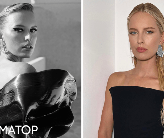 Топ-модель Каролина Куркова рассказала, как болезнь изменила ее внешность: Я просто не знала, что плохо выгляжу