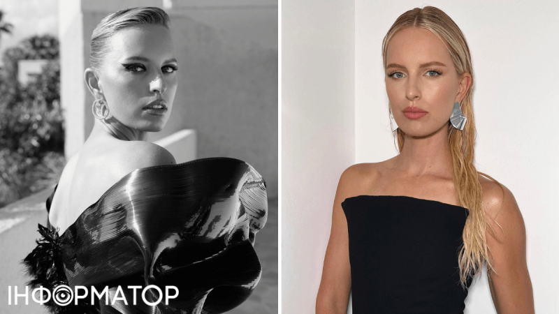 Топ-модель Каролина Куркова рассказала, как болезнь изменила ее внешность: Я просто не знала, что плохо выгляжу