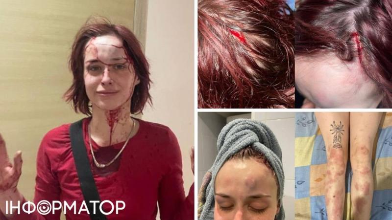 В Одессе мужчина в военной форме избил девушку костылем: ТЦК начал проверку