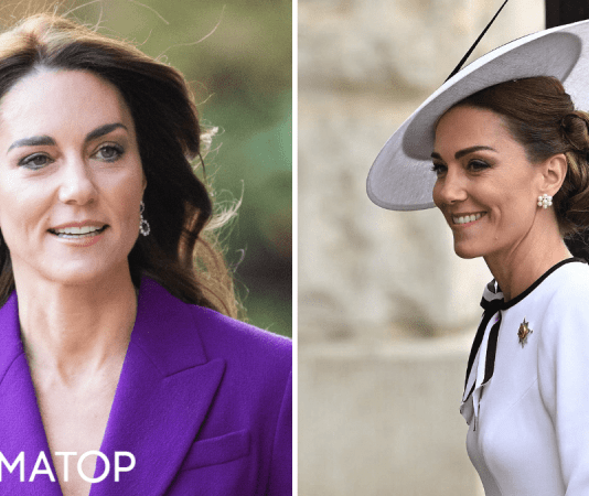 Делала ли Кейт Миддлтон пластическую операцию: врач сравнил фотографии