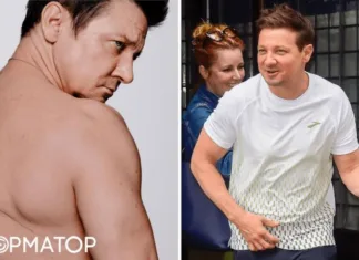 Я помню, как треснул мой череп: звезда фильмов Marvel изуродован после несчастья