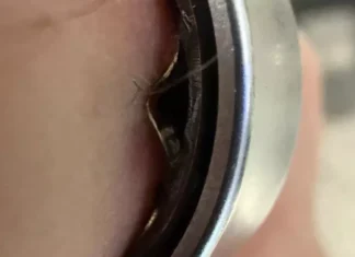 Samsung Galaxy Ring: молниеносный эксцесс с треснувшей батареей довел пользователя до больницы