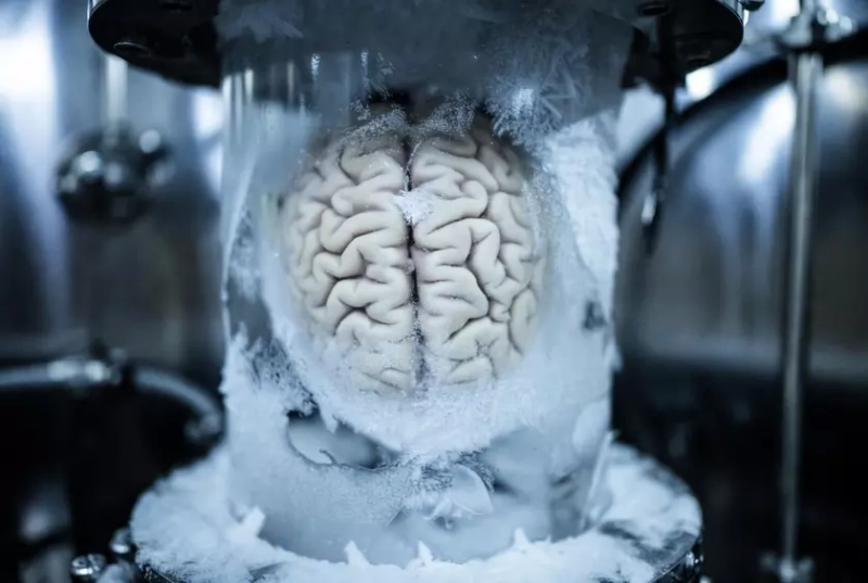 нейроны мозга при заморозке