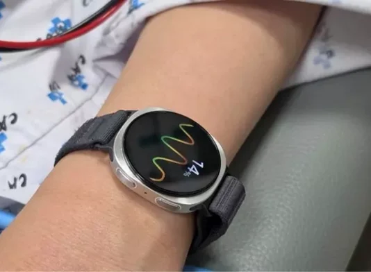 Революция в диагностике: Samsung научила Galaxy Watch 6 предотвращать обмороки